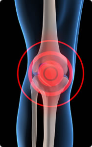 Joint Pain