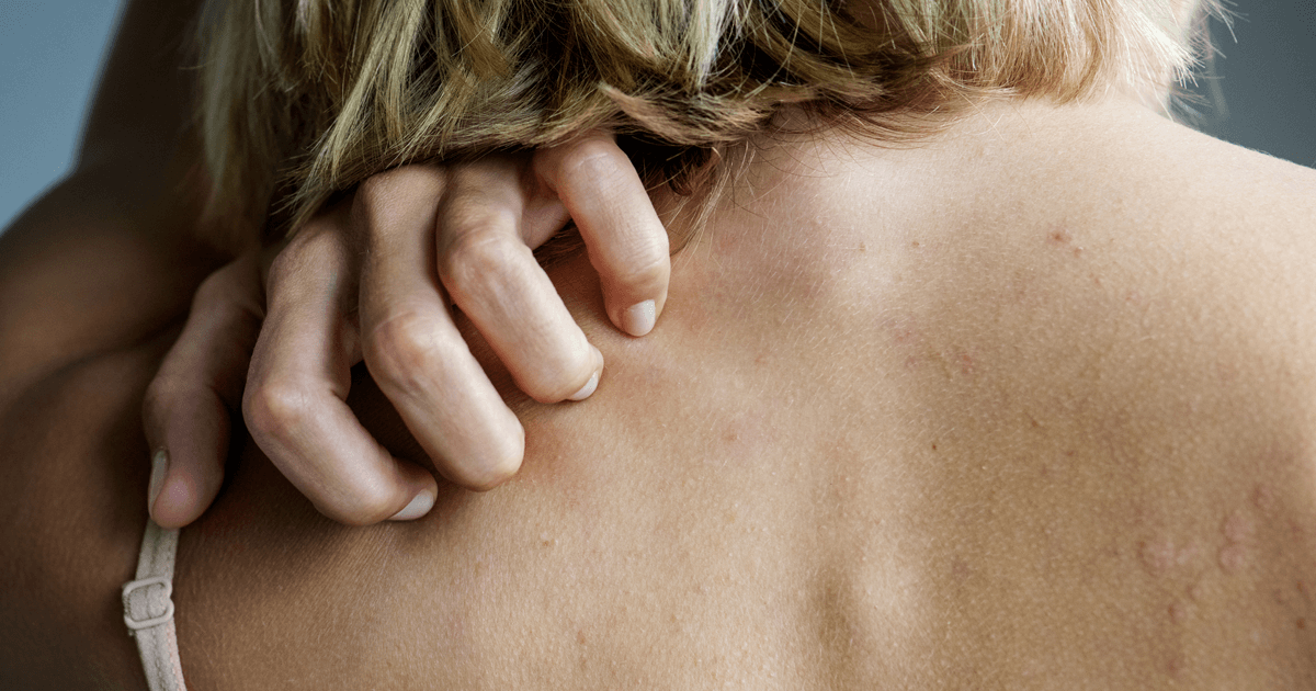 Surprising things that can irritate your sensitive skin in menopause