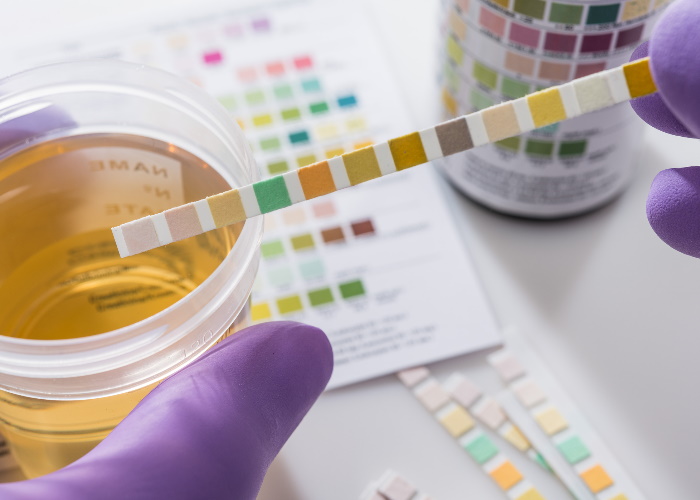 What are 5 signs and symptoms of a UTI?