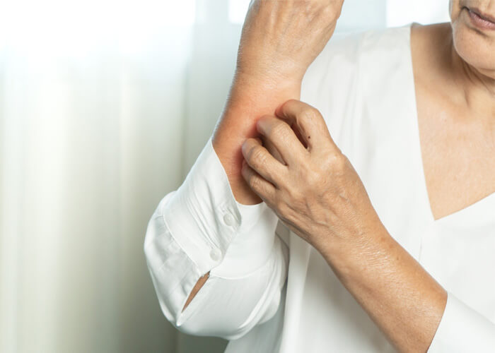 Is it normal to have itchy skin all over in perimenopause and menopause?
