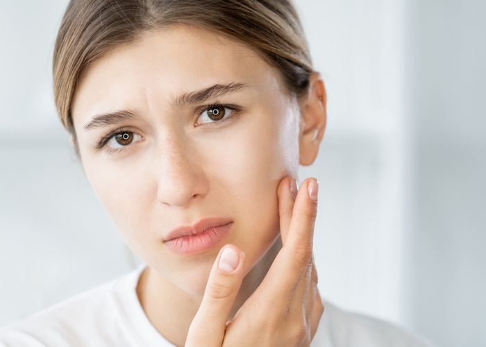 4 herbs for premenstrual acne
