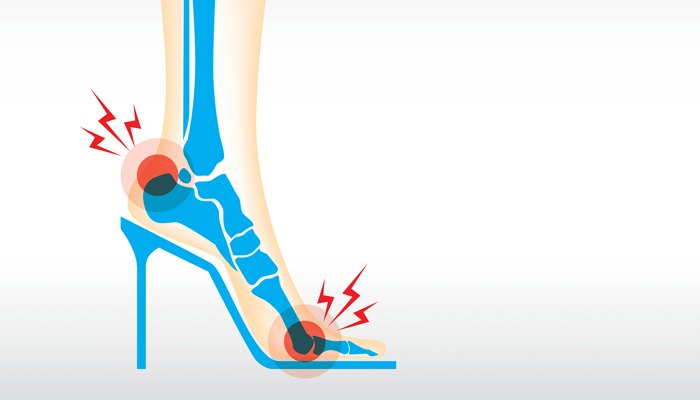 back pain from heels
