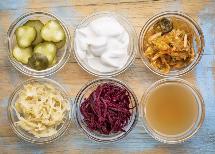 My guide to fermented foods for a flatter tum