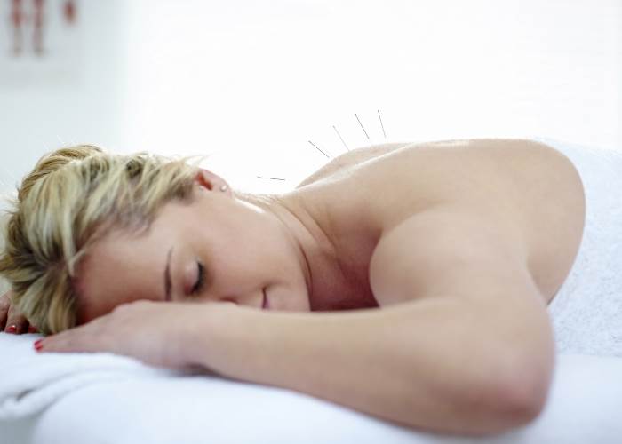 How acupuncture helped my bladder problems: part 2