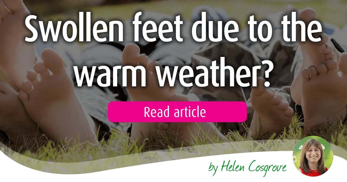 Swollen feet due to the warm weather?