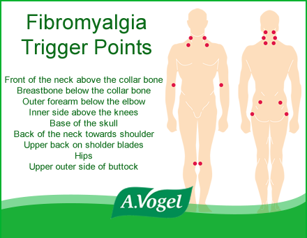 Fibromyalgia Pressure Points Chart