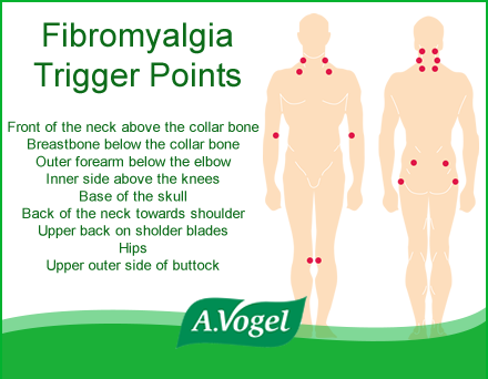 Upper Back Trigger Points Chart