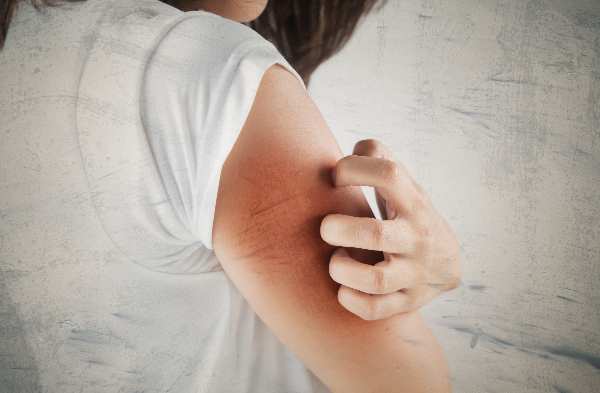 Why do I get dry skin during pregnancy?