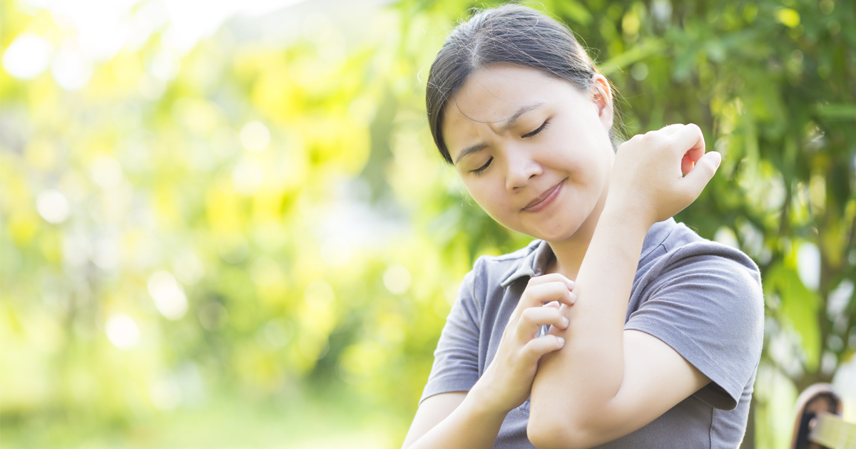 Why does hayfever make eczema worse?