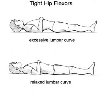 The Surprising Cause of Tight Hip Flexors (and How to Fix It