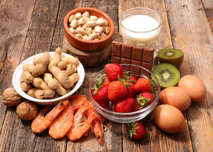 Why are food allergies becoming more common?
