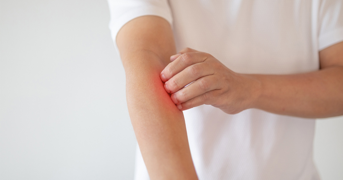 Understanding and Managing Body Itching