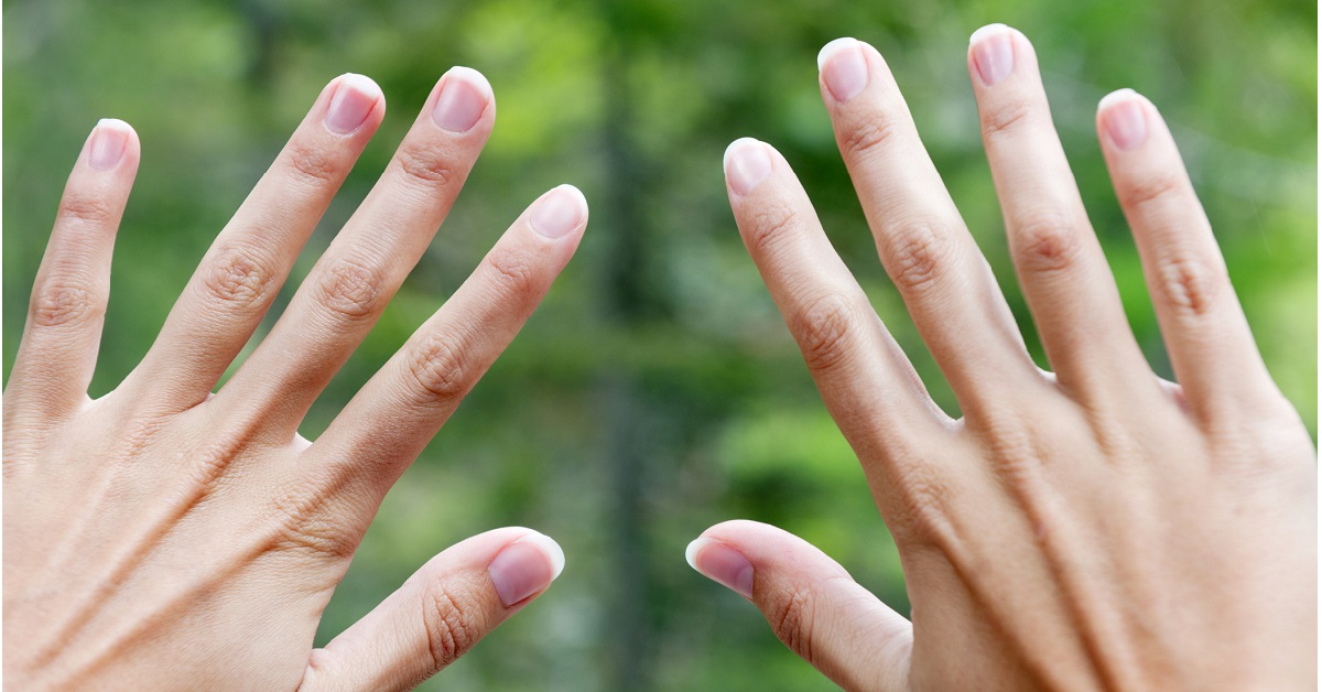 Top 10 reasons for brittle and deformed nails | TheHealthSite.com