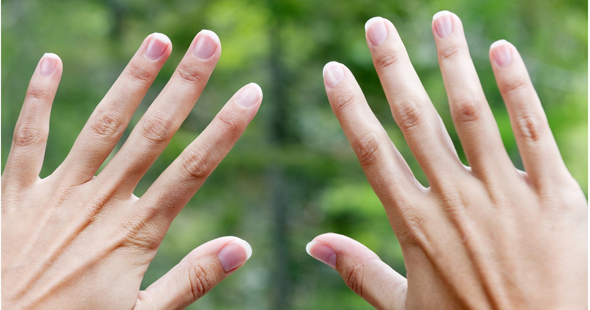 The 5 ways your nails may reveal if you've had COVID