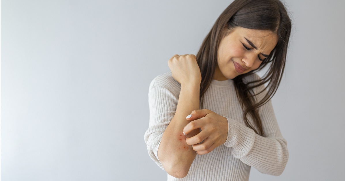 Does eczema mean you have a weak immune system?