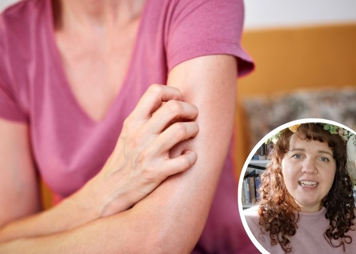 Why Do I Have Itchy Skin During Menopause? Naturopath Explains