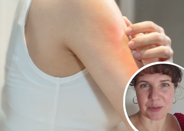 How to Ease Itchy Ears and Skin in Perimenopause